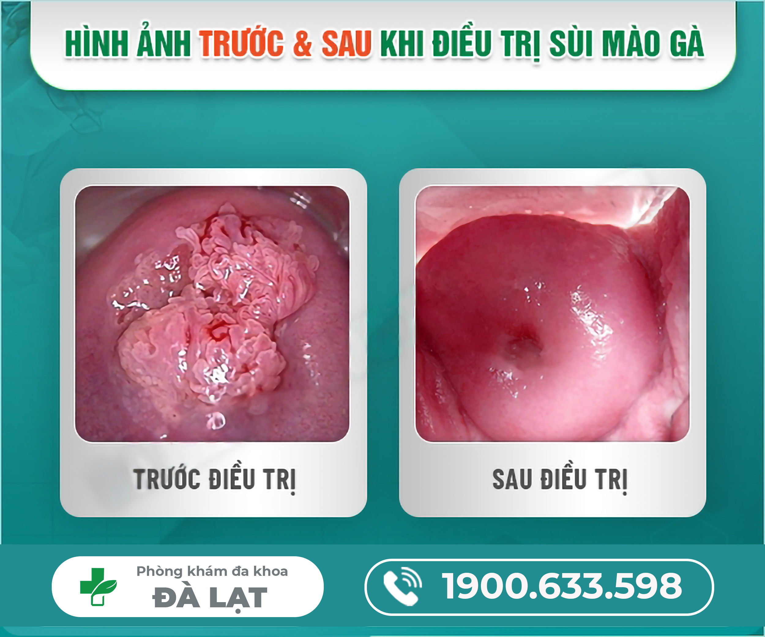 Hình ảnh minh họa